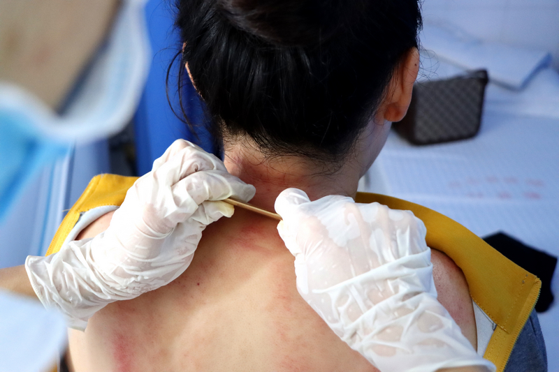 利民服務再升級 獨山縣人民醫院新增中醫護理門診。